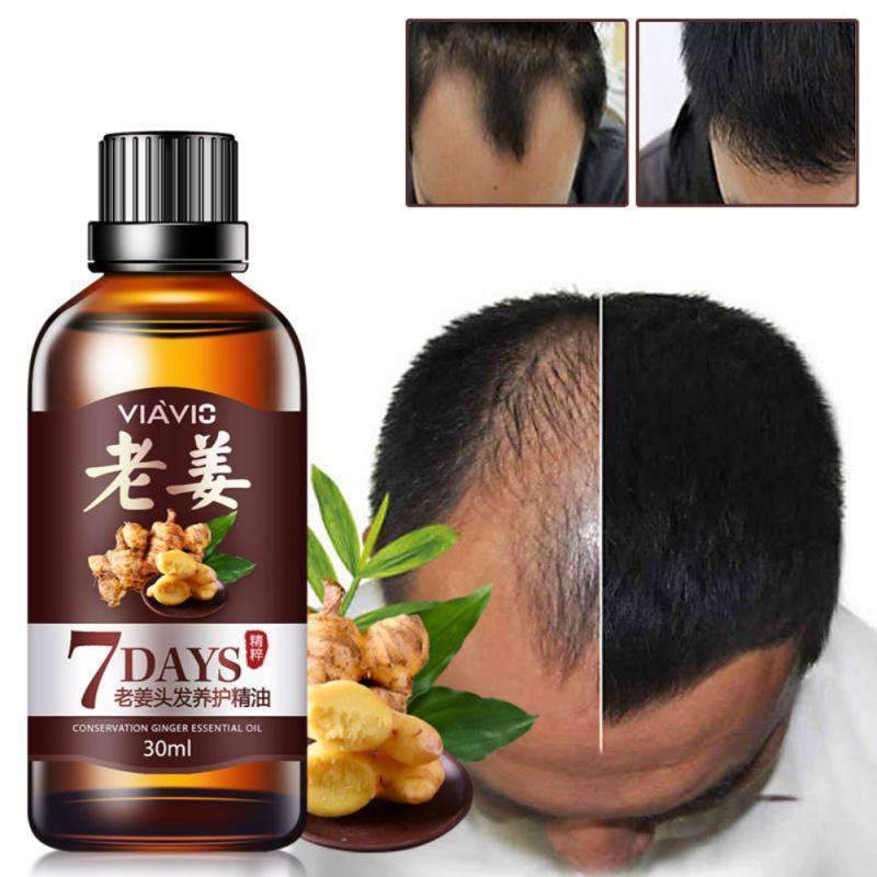 7 Days Ginger Hair Loss Products Essential Oil Care Essence for Men & Women Hair Loss Products Maquiagem Cosmetic Store