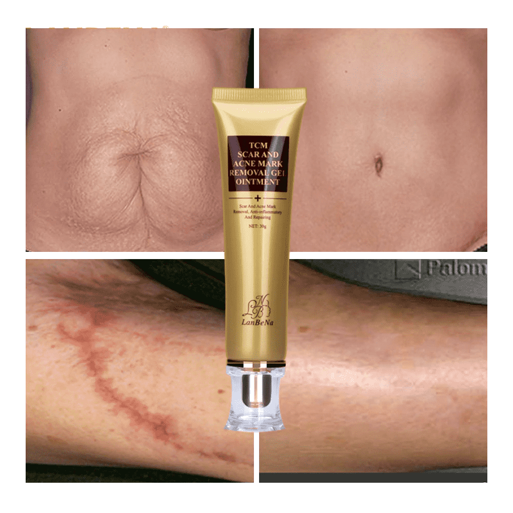 Acne Scar Removal Cream Skin Repair Whitening Facial Self Tanners Cream Facial Self Tanners & Bronzers LANBENA Official Store