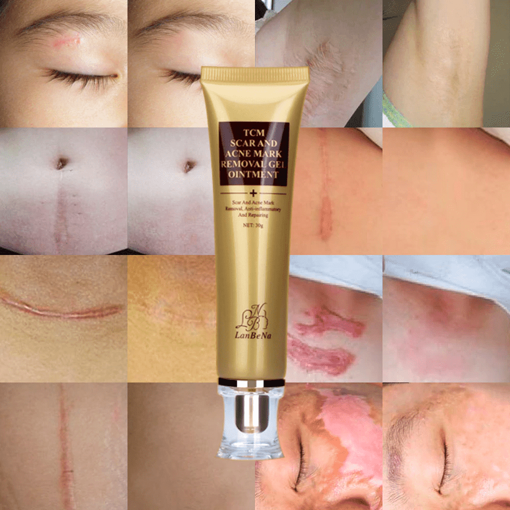 Acne Scar Removal Cream Skin Repair Whitening Facial Self Tanners Cream Facial Self Tanners & Bronzers LANBENA Official Store