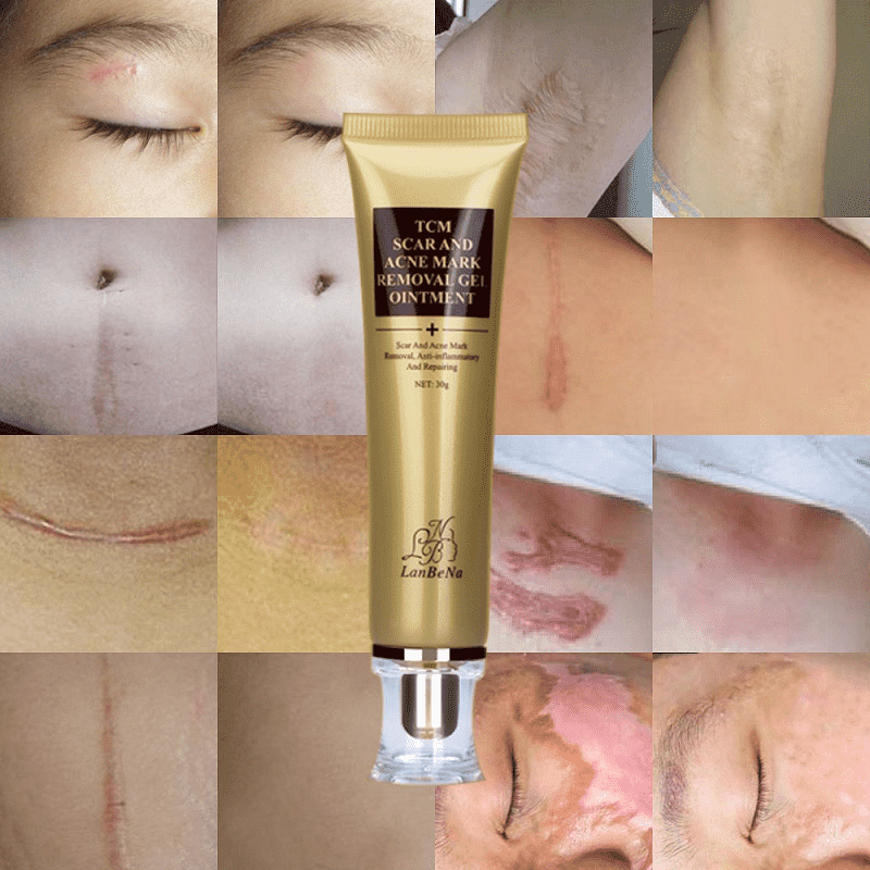 Acne Scar Stretch Marks Remover Whitening Facial Self Tanners Cream Facial Self Tanners & Bronzers LoveUrBeauty Store