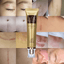 Acne Scar Stretch Marks Remover Whitening Facial Self Tanners Cream Facial Self Tanners & Bronzers LoveUrBeauty Store