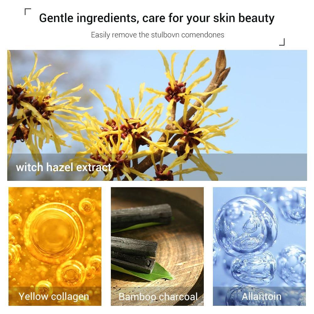 Acne Treatment Pore Strip Blackhead Remover Treatments & Masks LANBENA Official Store
