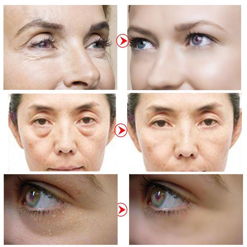 Anti-Aging Gold Collagen Eye Mask Creams OEDO Official Store