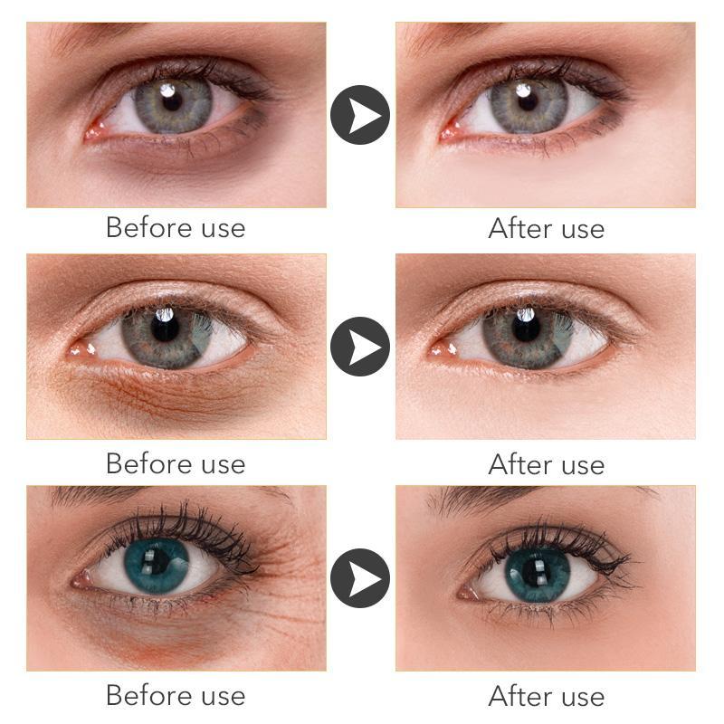 Anti-Aging Moisturizing Eye Wrinkle Patch Creams MEIKING Official Store