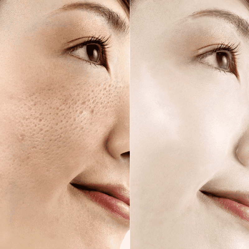 Anti Aging Skin Care Hyaluronic Acid Essence Facial Self Tanners Serum Facial Self Tanners & Bronzers OMYLADY Store
