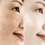 Anti Aging Skin Care Hyaluronic Acid Essence Facial Self Tanners Serum Facial Self Tanners & Bronzers OMYLADY Store