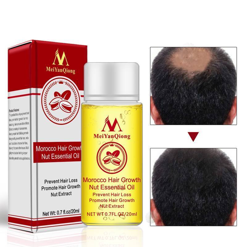 Anti Hair Loss Morocco Nuts Hair Growth Essence Hair & Scalp Treatments MeiYanQiong Official Store