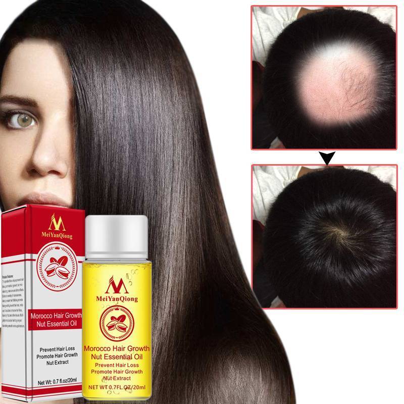 Anti Hair Loss Morocco Nuts Hair Growth Essence Hair & Scalp Treatments MeiYanQiong Official Store