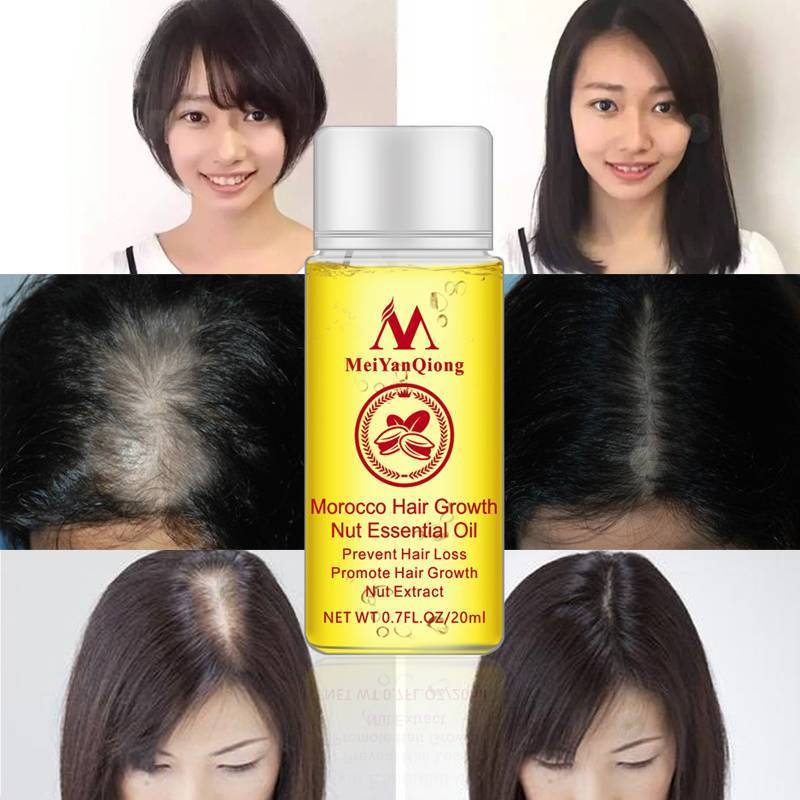 Anti Hair Loss Morocco Nuts Hair Growth Essence Hair & Scalp Treatments MeiYanQiong Official Store