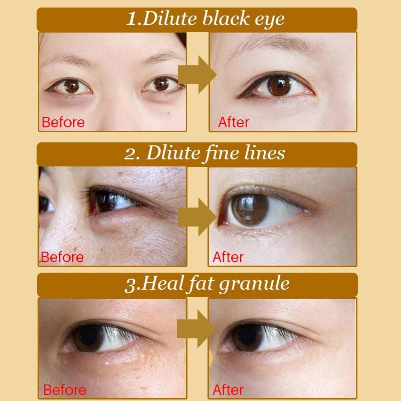Anti-Puffiness Crystal Eye Mask Creams Amy Golden Beauty