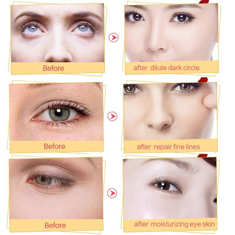 Black EyeCare Face Masks Creams Zala915212 Store