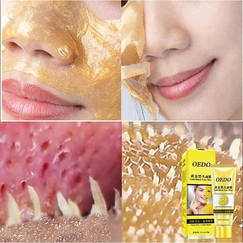 Black Spots Stains Face Pores Clean Gold Mask Treatments & Masks Beautiful Life SkinCare Store