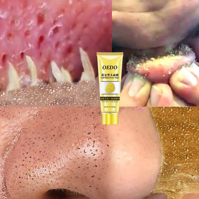 Black Spots Stains Face Pores Clean Gold Mask Treatments & Masks Beautiful Life SkinCare Store