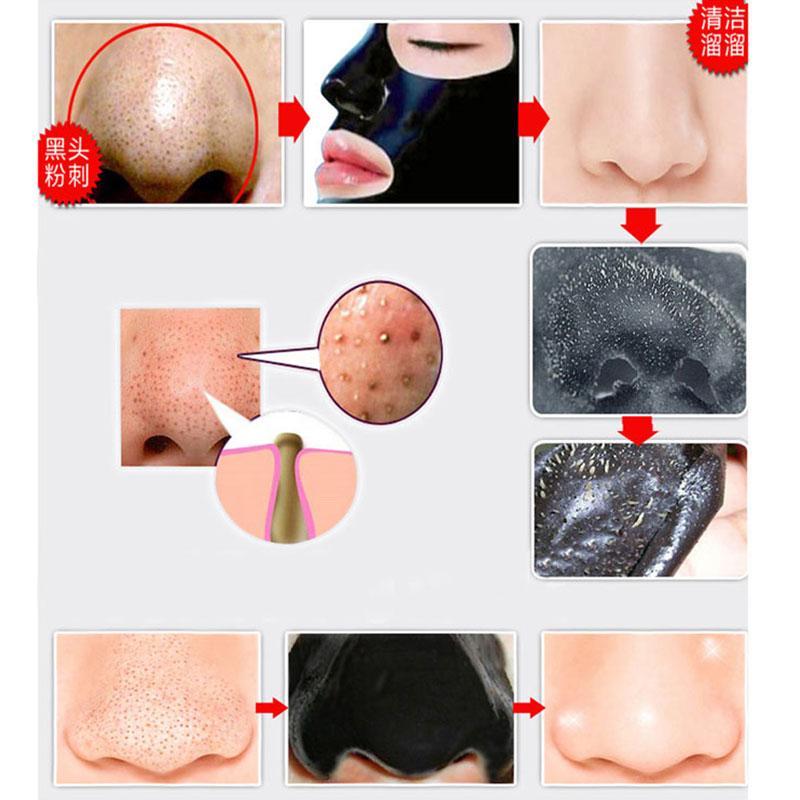 Blackhead Remover Nose Mask Treatments & Masks Wellcome sotre