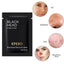 Blackhead Remover Nose Mask Treatments & Masks Wellcome sotre