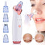 Blackhead Skin Care Products Acne Removal Beauty Products Face Skin Care Tools DearBeauty Store Standard type