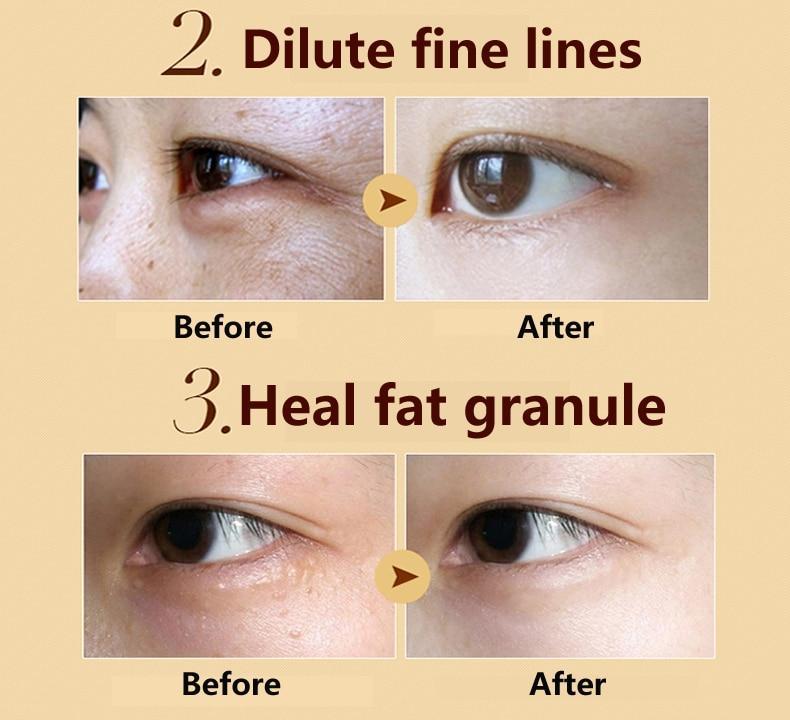 Crystal Bionic Eye Care Treatment & Mask Creams OEDO Official Store