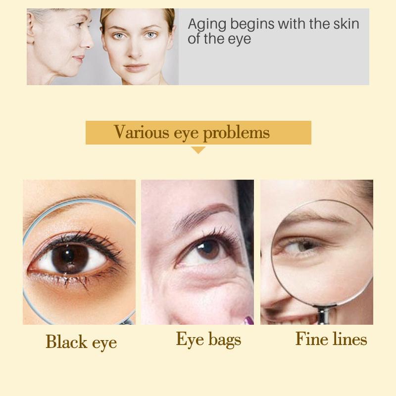 Dark Circle Remove Eye Patches Creams PARKnSHOP