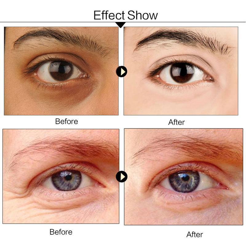 Dark Circle Remove Eye Patches Creams PARKnSHOP
