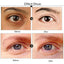 Dark Circle Remove Eye Patches Creams PARKnSHOP