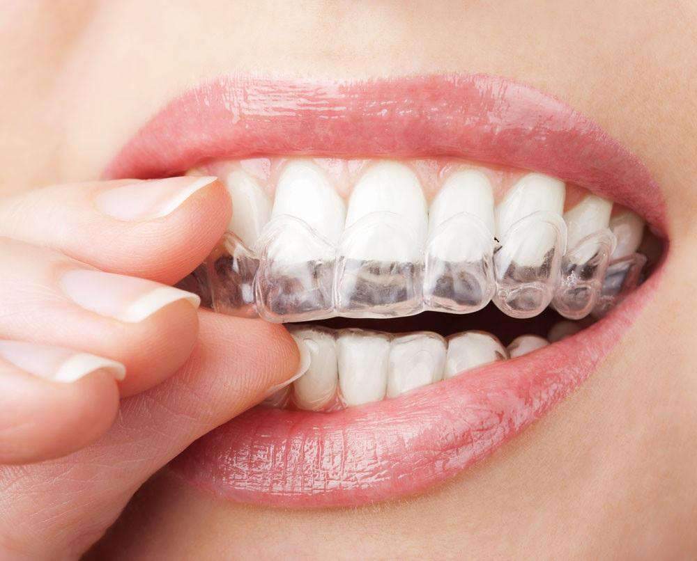 Dental Mouth Guard Teeth Whitener Trays Oral Hygiene Products Teeth Whitening Shop2220059 Store Default Title