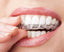 Dental Mouth Guard Teeth Whitener Trays Oral Hygiene Products Teeth Whitening Shop2220059 Store Default Title