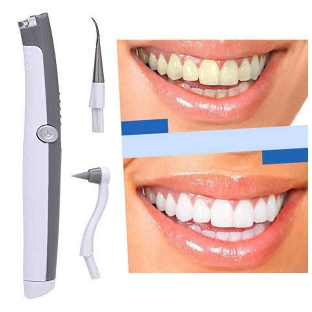 Electric Ultrasonic Tooth Strain Remover Oral Hygiene Product Teeth Whitening guomin yang's store