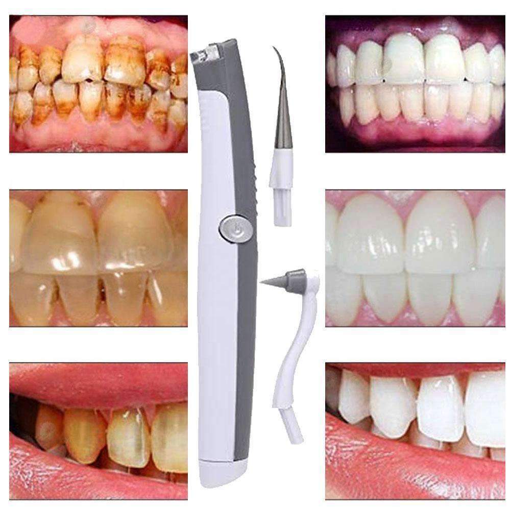 Electric Ultrasonic Tooth Strain Remover Oral Hygiene Product Teeth Whitening guomin yang's store