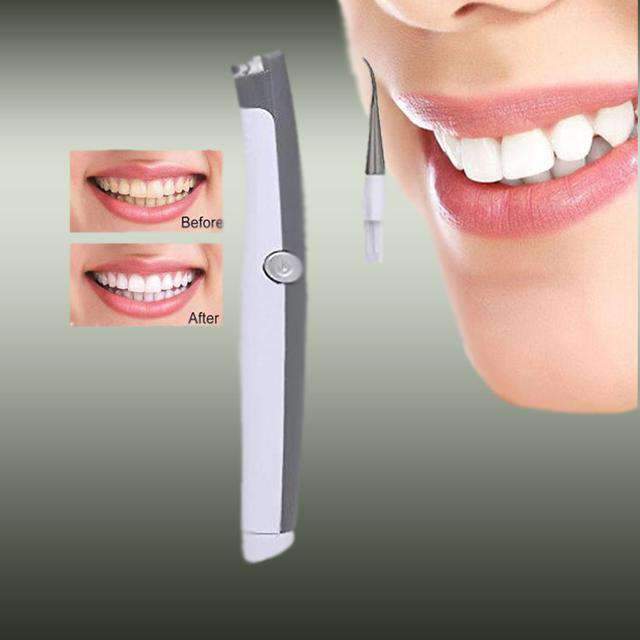 Electric Ultrasonic Tooth Strain Remover Oral Hygiene Product Teeth Whitening guomin yang's store