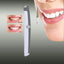 Electric Ultrasonic Tooth Strain Remover Oral Hygiene Product Teeth Whitening guomin yang's store