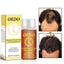 Essential Hair Loss Oil Hair Loss Products Dropshipping Save Money Makeup Store