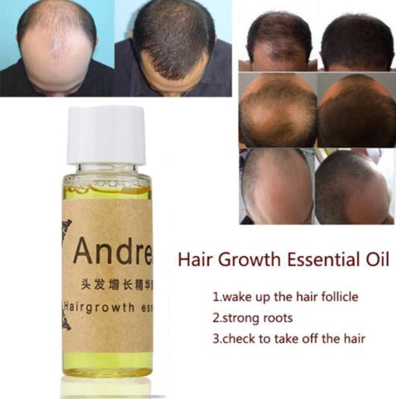 Fast Anti-Hair Loss Liquid Hair Loss Products Ageless Beauty Care