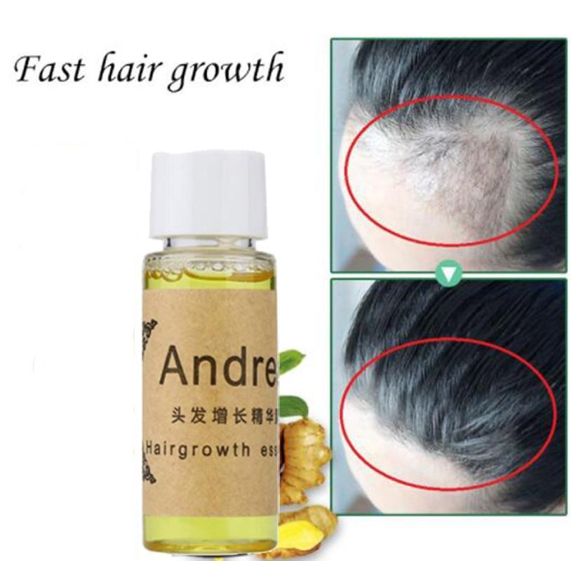 Fast Anti-Hair Loss Liquid Hair Loss Products Ageless Beauty Care