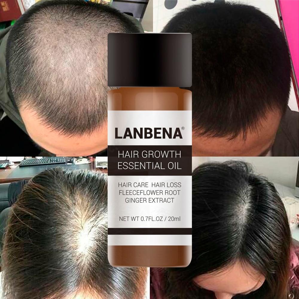 Fast Powerful Hair Growth Oil Hair Loss Products BaLaLa