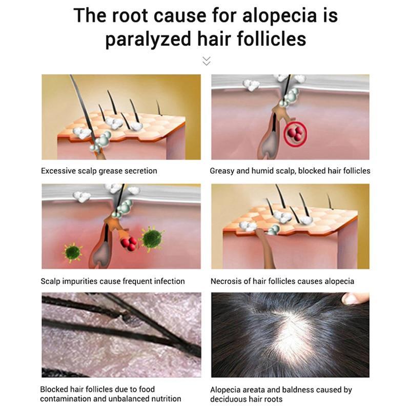 Fast Powerful Hair Growth Oil Hair Loss Products BaLaLa