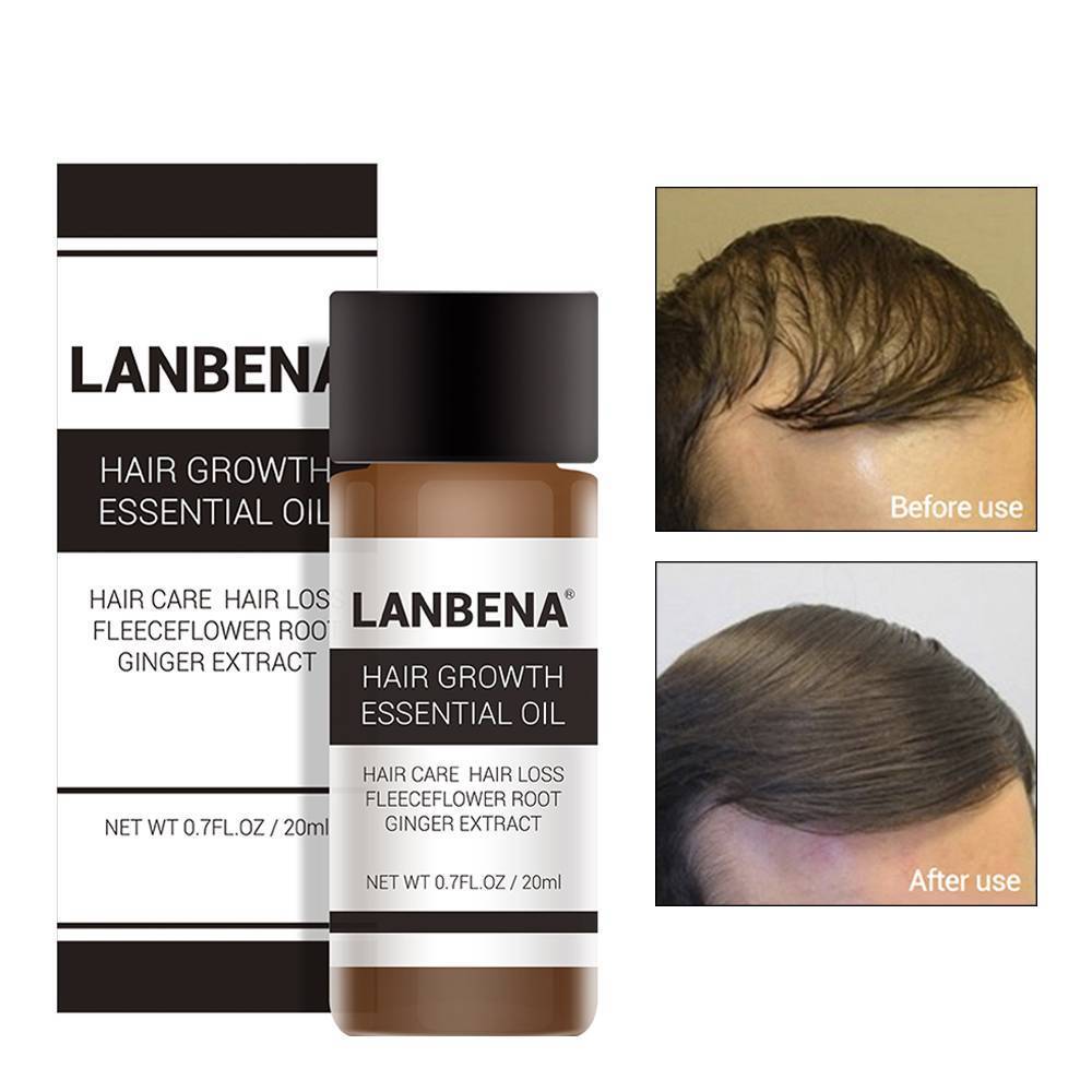 Fast Powerful Hair Growth Oil Hair Loss Products BaLaLa