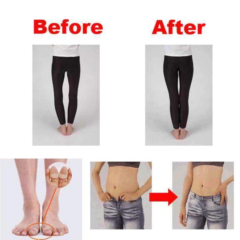 Fast Weight Lose Toe Rings Magnetic Weight Loss Products Slimming Creams iFashion Beauty