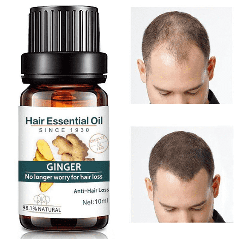 Ginger Liquid Hair Loss Products Dense Serum Natural Pure Oil for Men & Women Hair Loss Products Maquiagem Cosmetic Store
