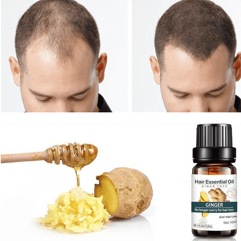 Ginger Liquid Hair Loss Products Dense Serum Natural Pure Oil for Men & Women Hair Loss Products Maquiagem Cosmetic Store