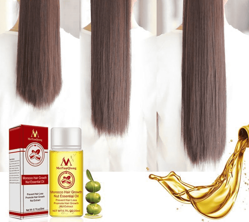 Ginger Oil Faster Growth Shampoo Hair Loss Treatment Products Hair Loss Products International Beauty Wholesale Mall