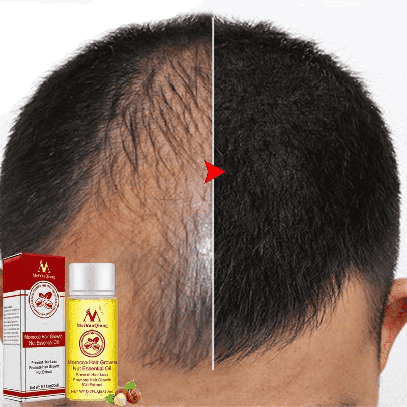 Ginger Oil Faster Growth Shampoo Hair Loss Treatment Products Hair Loss Products International Beauty Wholesale Mall