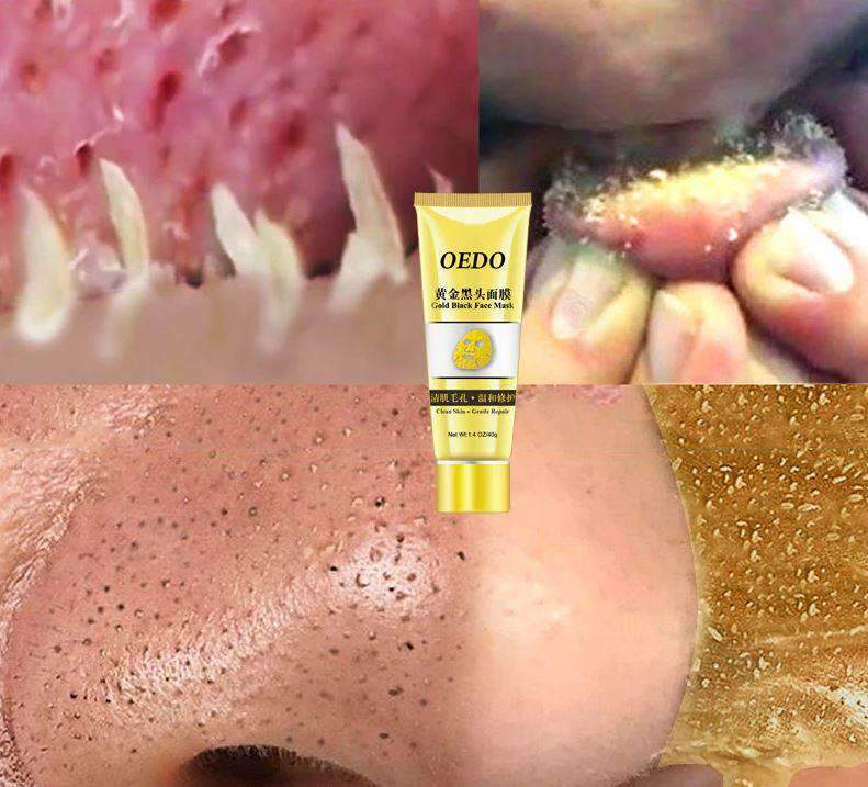 Gold Mask Facial Moisturizer Cream for Blackhead Shrink Pore Treatments & Masks OEDO Official Store Default Title