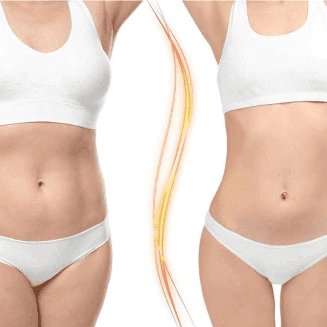 Health Care Strong Efficacy Navel Slimming Patch Weight Loss Products Slimming Product iFashion Beauty