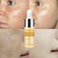 Hyaluronic Acid Whitening Serum Serum LANBENA Official Store