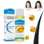 Liquid Hair Restoration Essence Hair Loss Products ONER Technology Co., Ltd