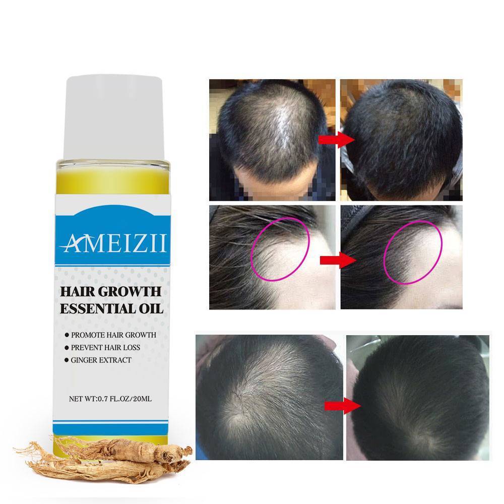 Liquid Hair Restoration Essence Hair Loss Products ONER Technology Co., Ltd