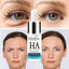 MABOX Hyaluronic Acid Shrink Pore Acne Treatment Serum Serum MABOX Official Store