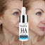 MABOX Hyaluronic Acid Shrink Pore Acne Treatment Serum Serum MABOX Official Store