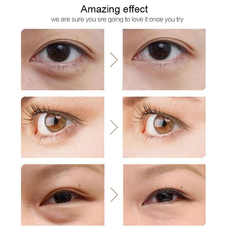 Moisturizing Repair Eye Patches Creams Wellcome sotre