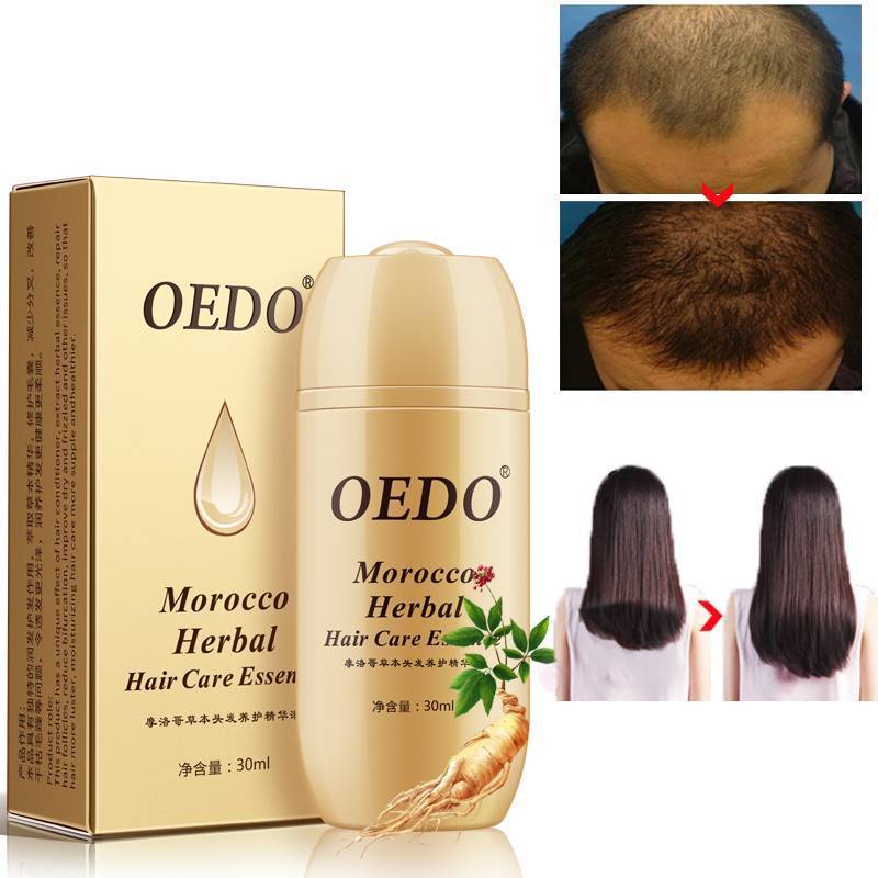 Morocco Herbal Essence Hair Growth Serum Hair & Scalp Treatments MYQNO01 Store